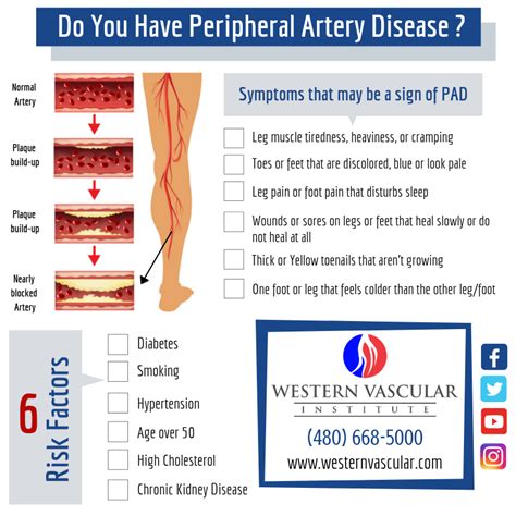 peripheral vascular disease treatment - TesstaroJuarez