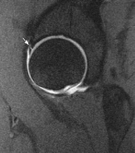 Diagnostic Imaging of the Hip for Physical Therapists - Physiopedia