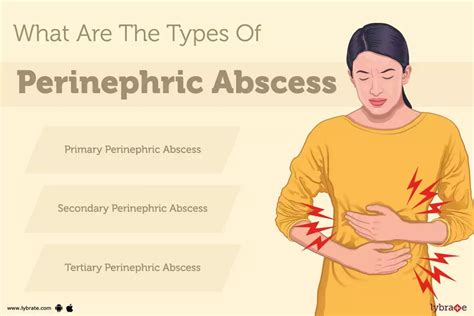 Perinephric Abscess: Causes, Symptoms, Treatment and Cost