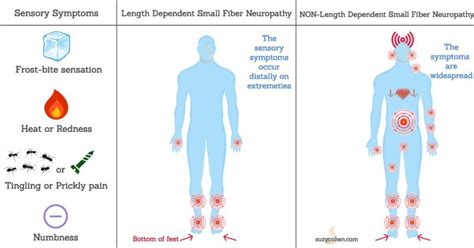 Small Fiber Neuropathy Causes and Treatment - Suzy Cohen, RPh offers ...