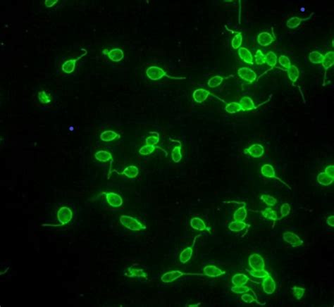 Crithidia luciliae slides for the detection of anti-nDNA antibodies ...