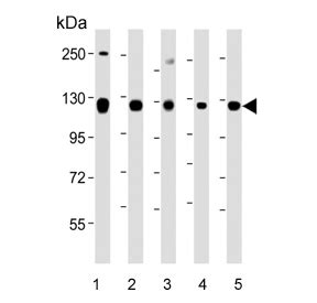 ROR2 Antibody | F54941 NSJ Bioreagents