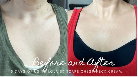 How to get rid of Chest and Neck Wrinkles! - MOM ON A MISSION