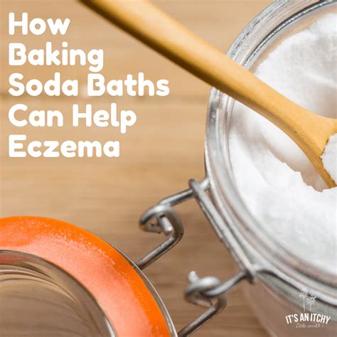 Why Baking Soda Baths for Eczema Can Work!