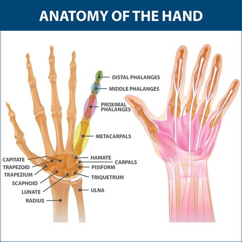 Rheumatoid Arthritis Of The Hand | Florida Orthopaeidic