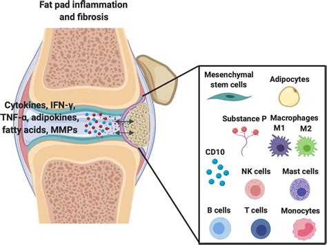 Frontiers | Infrapatellar Fat Pad/Synovium Complex in Early-Stage Knee ...