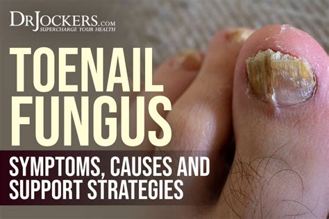 Types of Toenail Fungus: Pictures, Symptoms, Treatment, with different ...