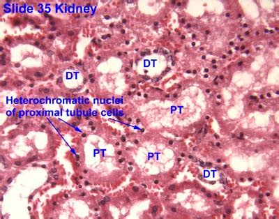 Renal Tubule Histology