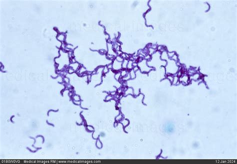 Gram Negative Spirilla