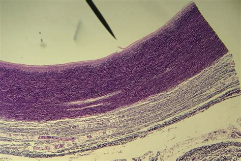 Histology Of Aorta