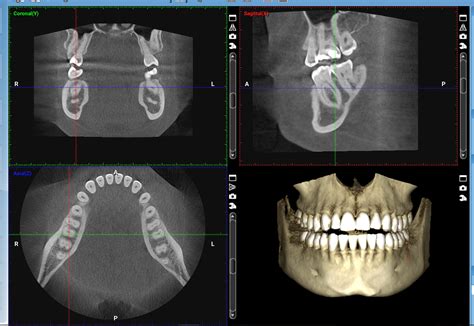 Cone Beam Dental - 🥇🦷Diagnóstico Odontológico por Imagen🦷🥇