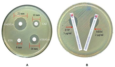 Antimicrobial susceptibility test. (A) Extended-spectrum β-lactamase ...