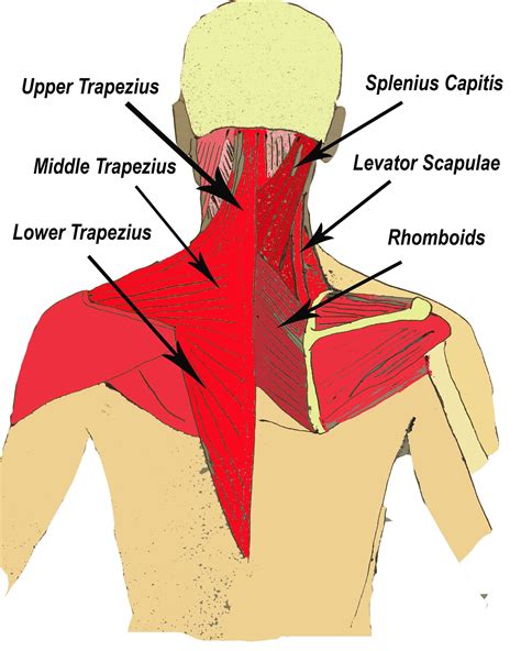 Levator Scapulae Headache - Headache