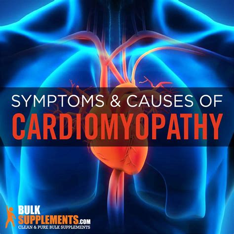 Cardiomyopathy: Symptoms, Causes & Treatment