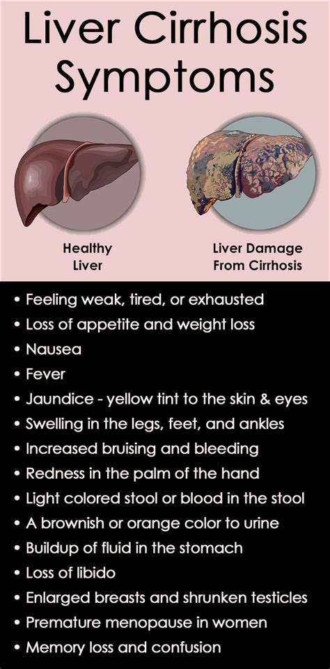 Liver Cirrhosis Symptoms Skin