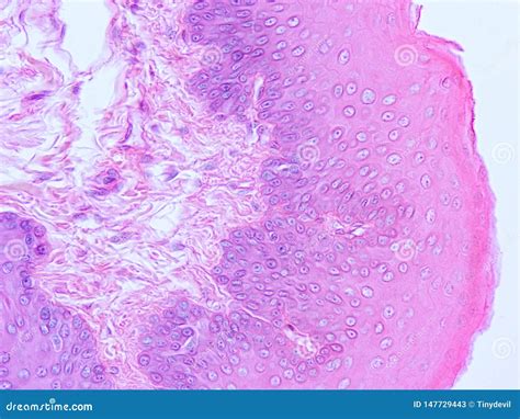 Histology of Epiglottis Human Tissue Stock Image - Image of microscopic ...