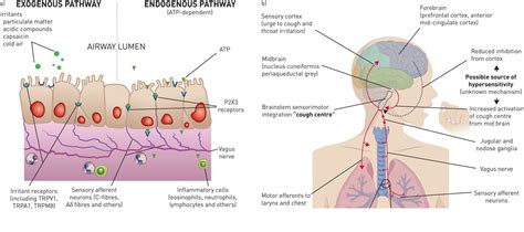 Neurogenic Cough Vagus Nerve Syndrome - Pregnant Center Informations