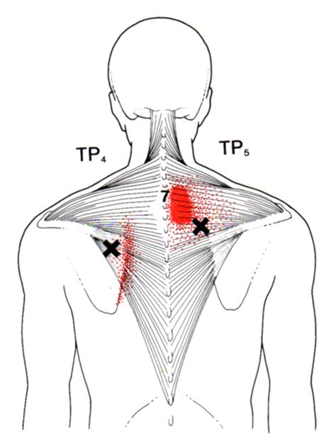 Pin auf Body