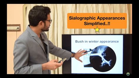 Sialographic Appearances - YouTube