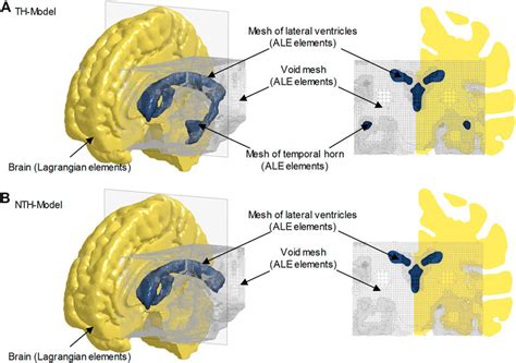 Frontiers | The Presence of the Temporal Horn Exacerbates the ...