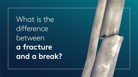 What is the difference between a fracture and a break? - YouTube