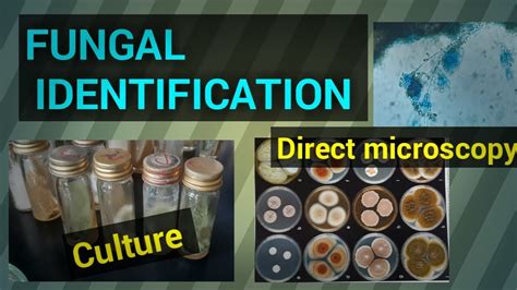 Fungal Identification