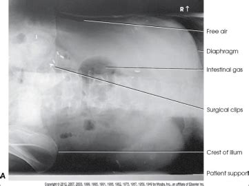 Abdomen Image Analysis - Radiography Image Analysis I with Ed Delhomme ...