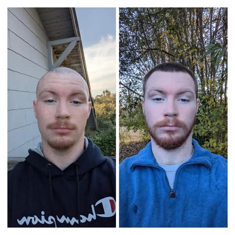 No Shave November Before & After (With Aftermath) : r/beards