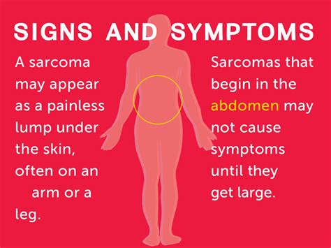 Signs and Symptoms of Soft Tissue Sarcomas | Dana-Farber Cancer Institute