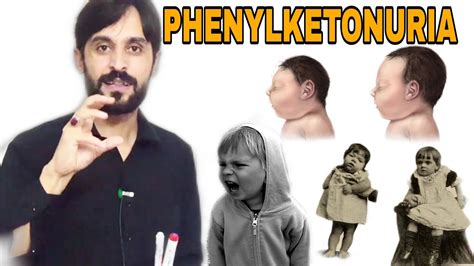 Phenylketonuria | Introduction | Causes | Symptoms and Treatment - YouTube