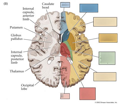 brain arterial supply 4 Diagram | Quizlet