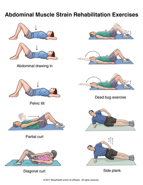 Summit Medical Group - Abdominal Muscle Strain Exercises