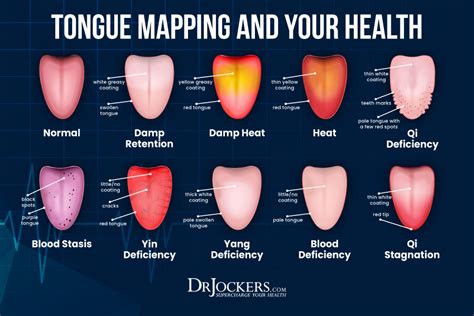 Tongue Mapping To Discover Hidden Health Problems