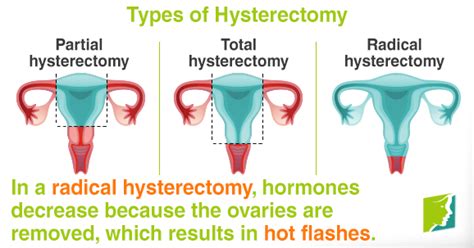 Hot Flashes after a Hysterectomy | Menopause Now