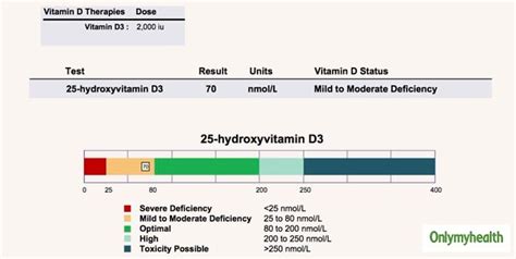 Excess Vitamin D Intake Is Harmful To Your Health, Know All About ...