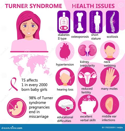 Turner Syndrome Infographic Vector. Signs, Health Issues. Short Stature ...