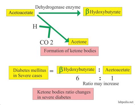 Urine Part 7:- ketones, Ketone Bodies (Ketonuria) – Labpedia.net