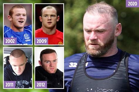 Wayne Rooney’s hair is thinning again — despite spending ‘£30k’ on hair ...