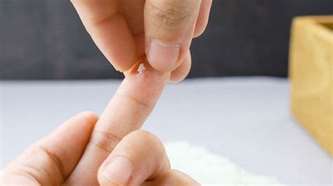 Super Glue on Skin: Here’s How to Get Rid of It