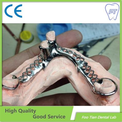 Good Product Pure Titanium Removable Metal Framework Denture - China ...