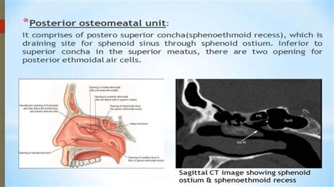 Surgical anatomy of osteomeatal complex