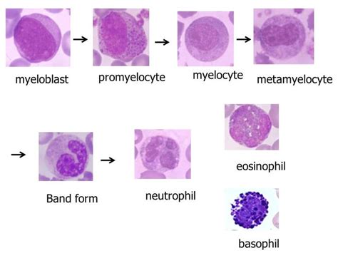 Image result for myelocyte | Hematology, Medical laboratory scientist ...