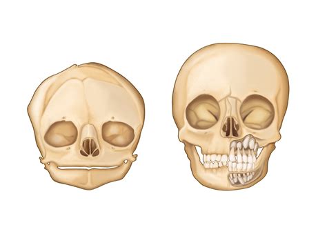 ArtStation - Infant vs. Developing Child Skull