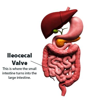 ileocecal-valve - Abdominal Health