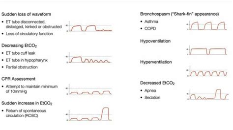 Capno wave explanations | Respiratory care, Advanced cardiac life ...