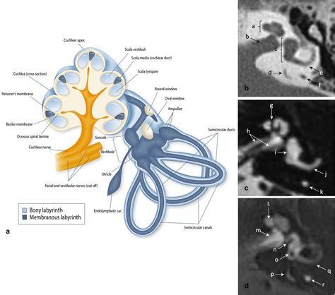 Anatomy of the inner ear.a Schematic depiction of the inner ear, which ...