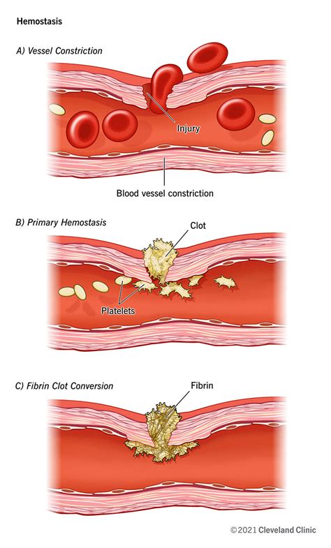 4 Describe How the Body Stops Bleeding