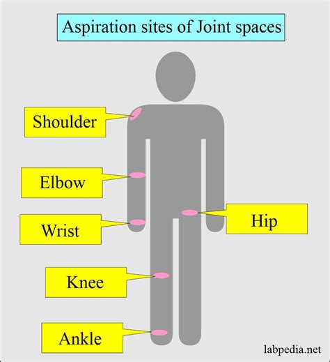 Synovial Fluid Analysis, Procedure for Arthrocentesis