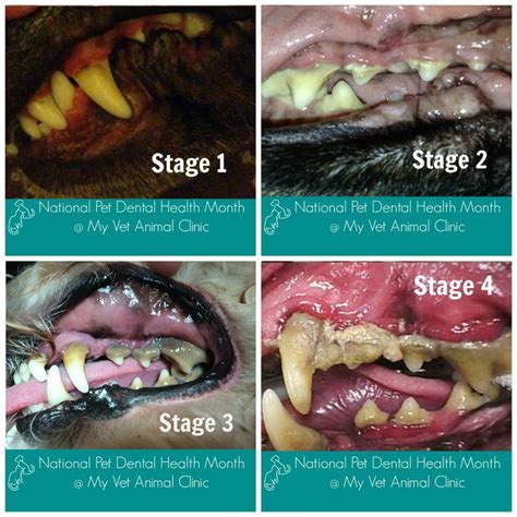 Four stages of periodontal disease. Preventive care and regular ...