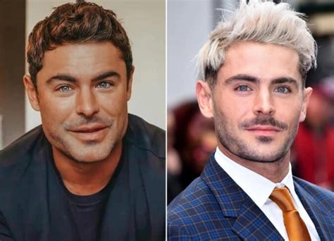 Zac Efron's Plastic Surgery: His Explanation For Why His Appearance Has ...